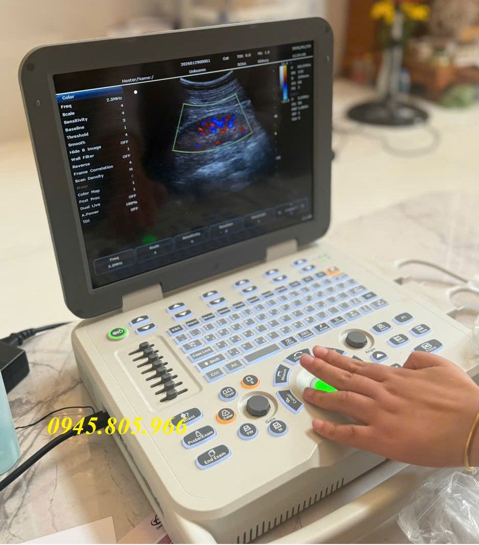 Top 7 máy siêu âm xách tay chất lượng, phân khúc giá dưới 100 triệu